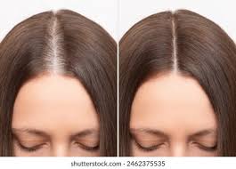 How to Thicken Thinning Hair in Women